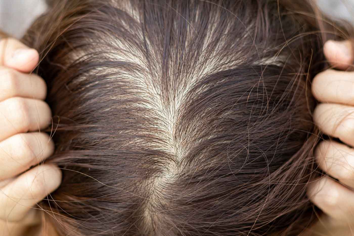 Hair Tattoo A New Technique to Camouflage Thinning Hair StyleSpeak